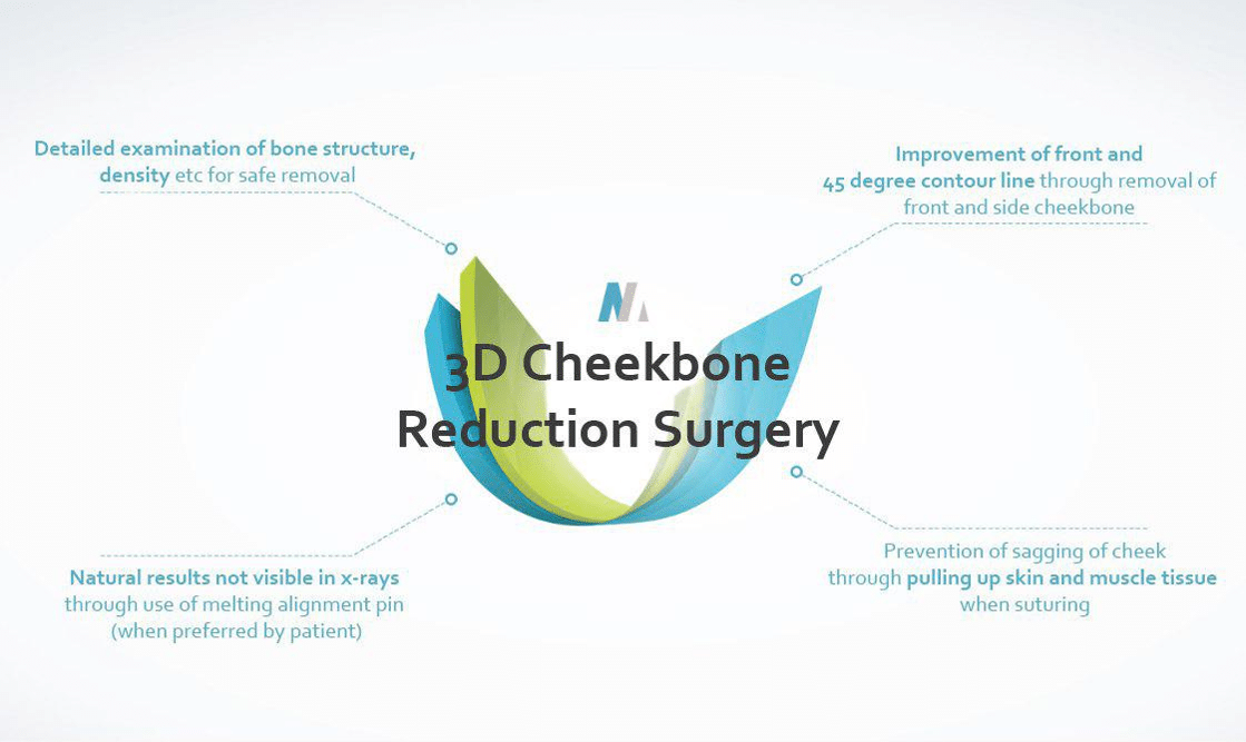 Cheekbone Reduction Semi 3D